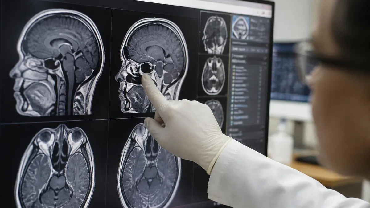 Ms and Mri - MRI - Magnetic Resonance Imaging certification study resource