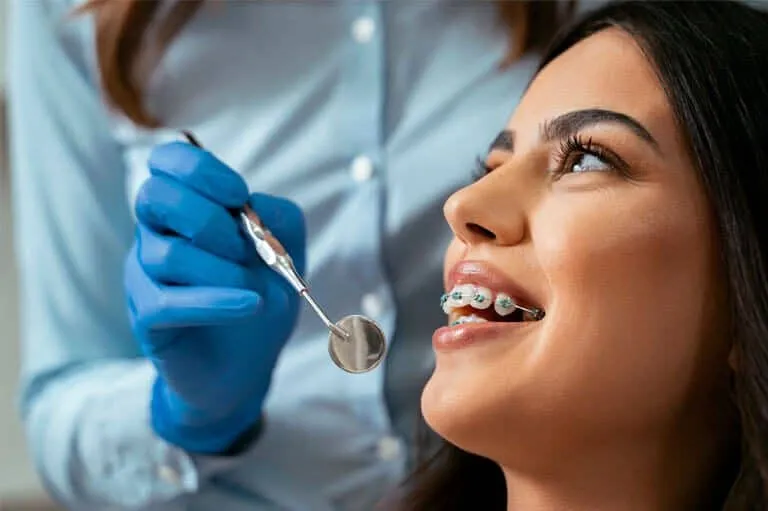 Dental Braces - Dental braces