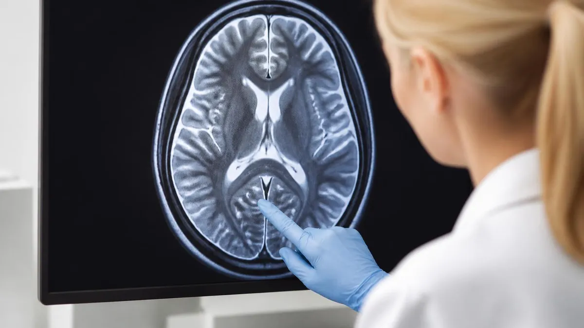 Mri Results Timelines - MRI - Magnetic Resonance Imaging certification study resource