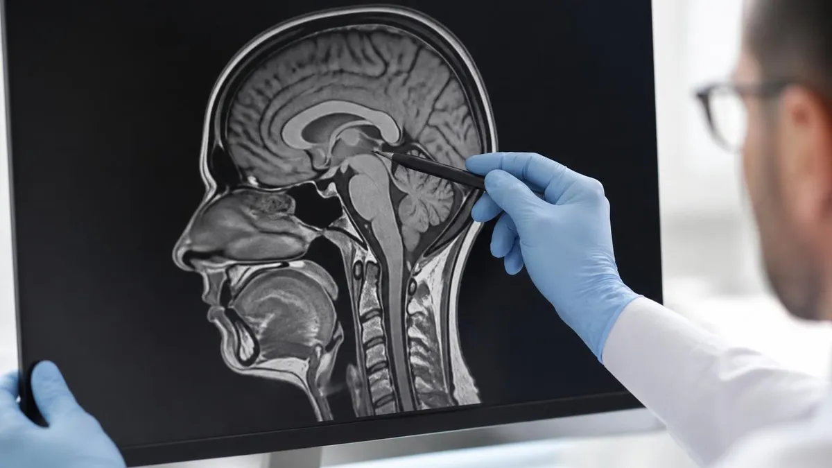 MRI of the Brain With and Without Contrast: Complete 2026 July Guide to How It Works, What It Shows, and What to Expect